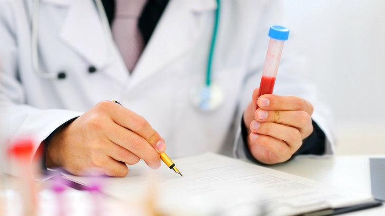 Ovo su simptomi da vašem tijelu nedostaje vitamin K