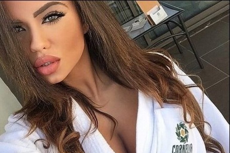 VIDEO &#8211; OVO je bogata misica iz Španije koja je povrijeđena u eksploziji u Zemunu
