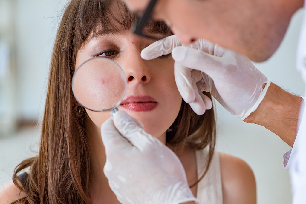 Znakovi da je vrijeme da posjetite dermatologa