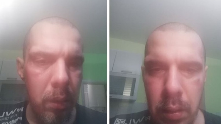 Pjevač Bojan Tomović pretučen u Beogradu