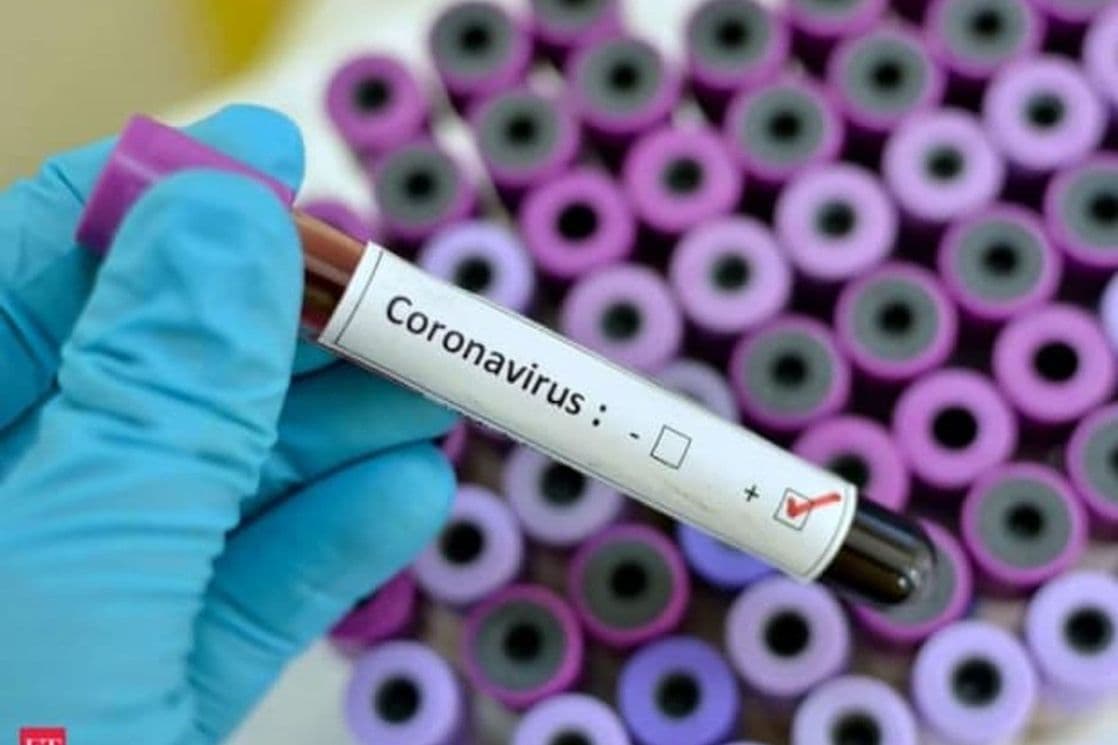 Korona virus: U Italiji 12 žrtava, na kruzeru umrle četiri osobe