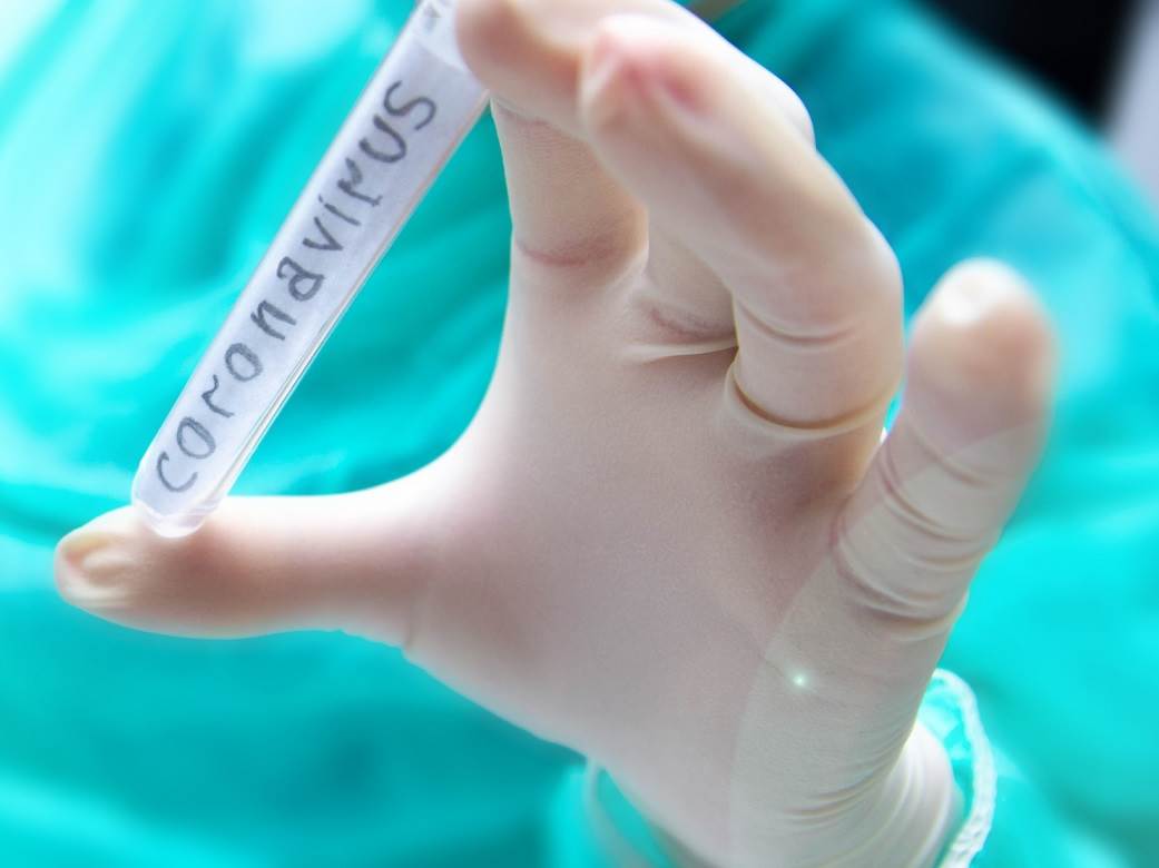 SZO razbila sve mitove o korona virusu! Paket iz Kine vas neće zaraziti, bijeli luk i antibiotik neće pomoći, ali ovo hoće