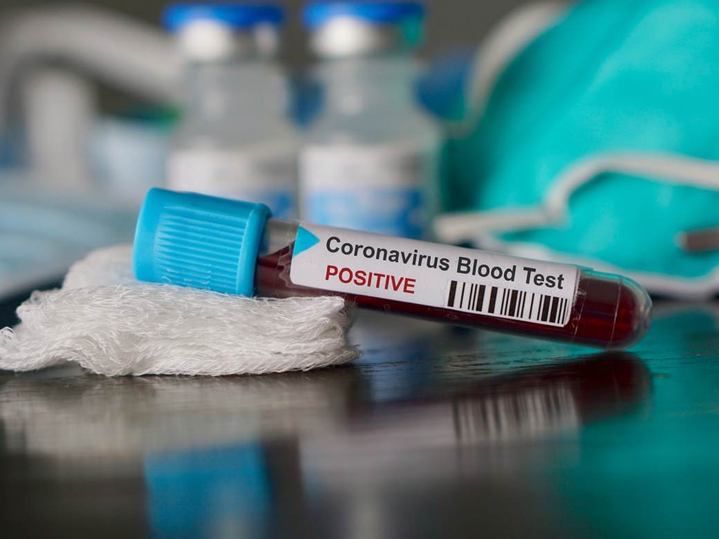 SZO proglasila koronavirus globalnom pandemijom!