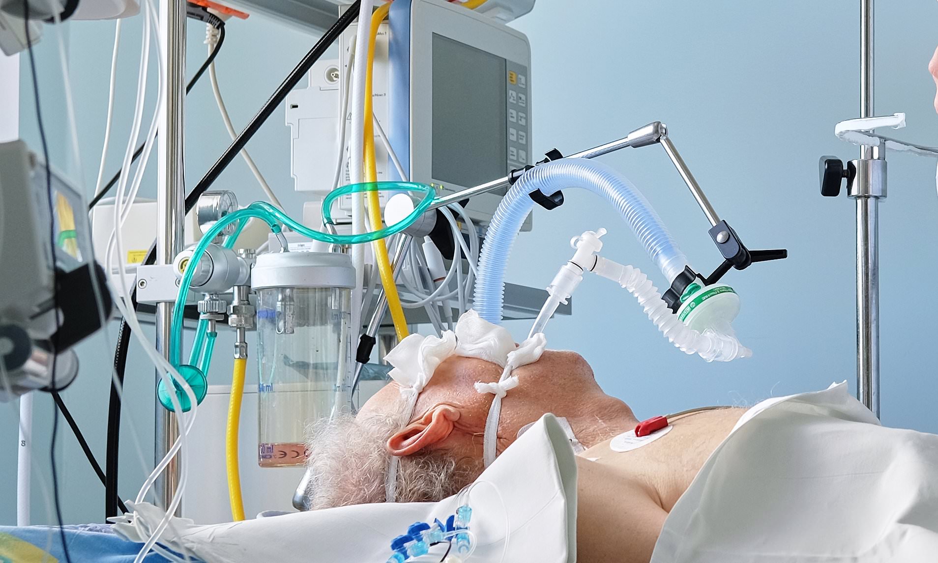 (VIDEO) Život posle respiratora može biti pakao za one koji su preživjeli Covid-19, neki opet uče da hodaju i žvaću