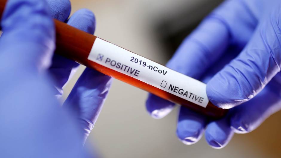 Nova 52 slučaja koronavirusa u Crnoj Gori, preminule 3 osobe