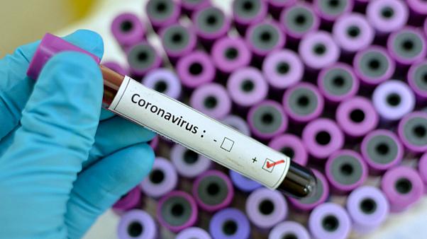 Nova 73 slučaja obolijevanja od koronavirusa u Crnoj Gori