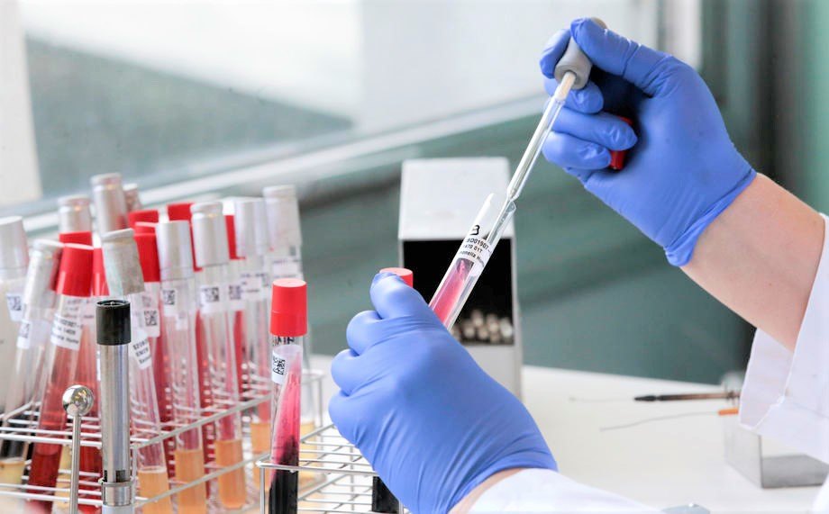 Korona virus kružio Italijom još u septembru prošle godine?