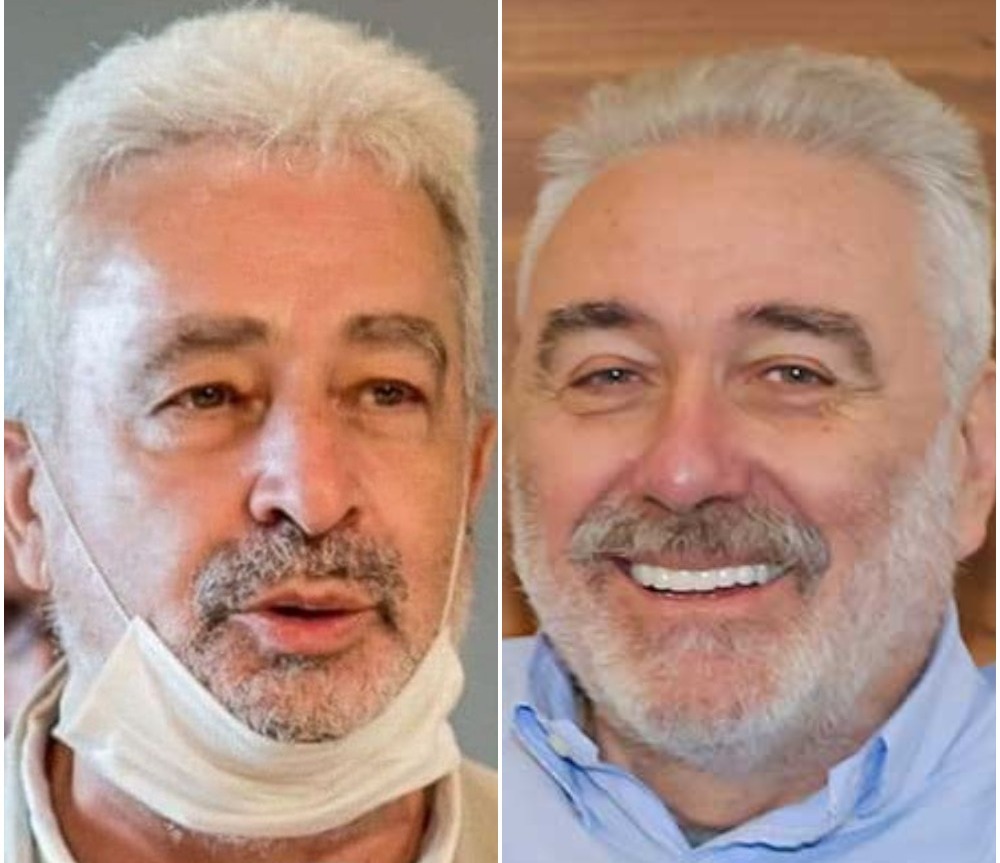 IZBOROM NOSIOCA LISTE DF  I SNP UNAPRIJED PRIZNALI PORAZ: Na čelu blizanac doktora Nestorovića