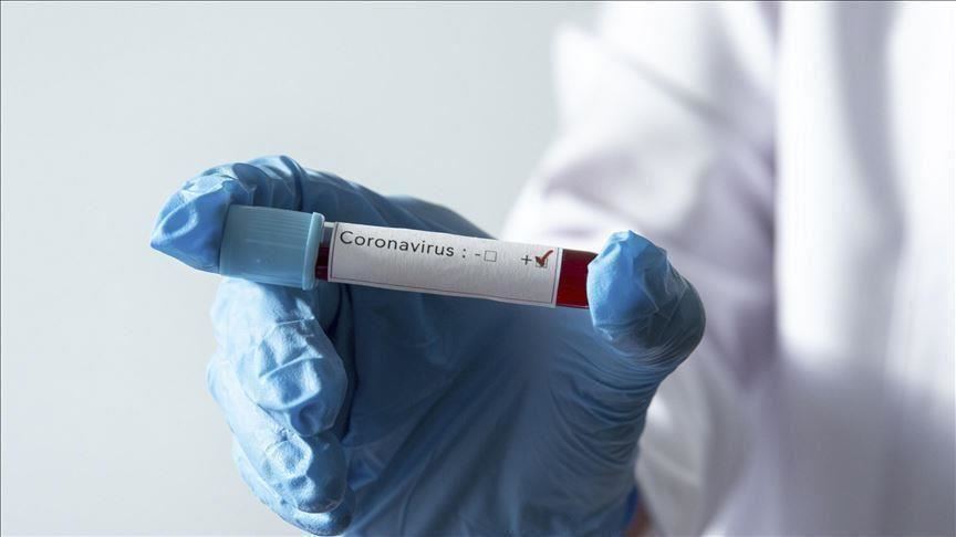 Novih 30 slučajeva koronavirusa, preminule dvije osobe