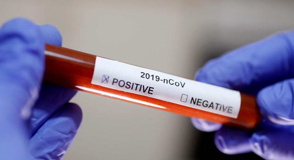 Registrovana 574 nova slučaja koronavirusa, preminulo pet osoba