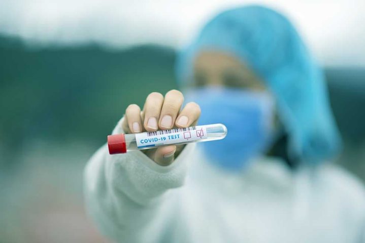U Srbiju se više ne može bez PCR testa