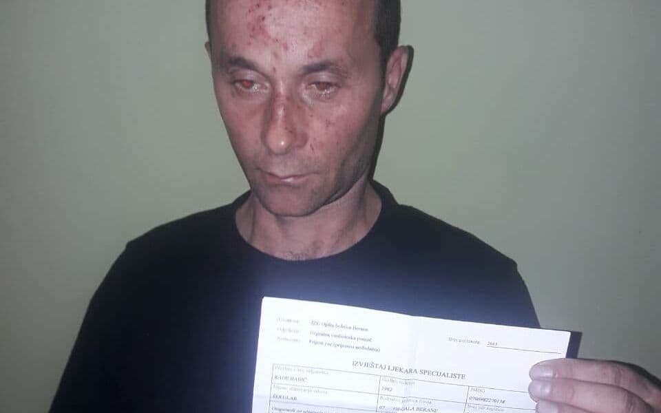 Rade Babić napadnut u Šekularima kod Berana: Kad će prestati hajka na Crnogorce?