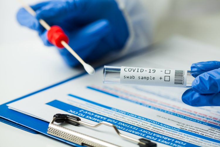 Crna Gora još nije akreditovala PCR testiranja i laboratorije