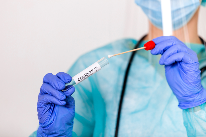 Kada je potrebno uraditi PCR test, a kada brzi antigenski?