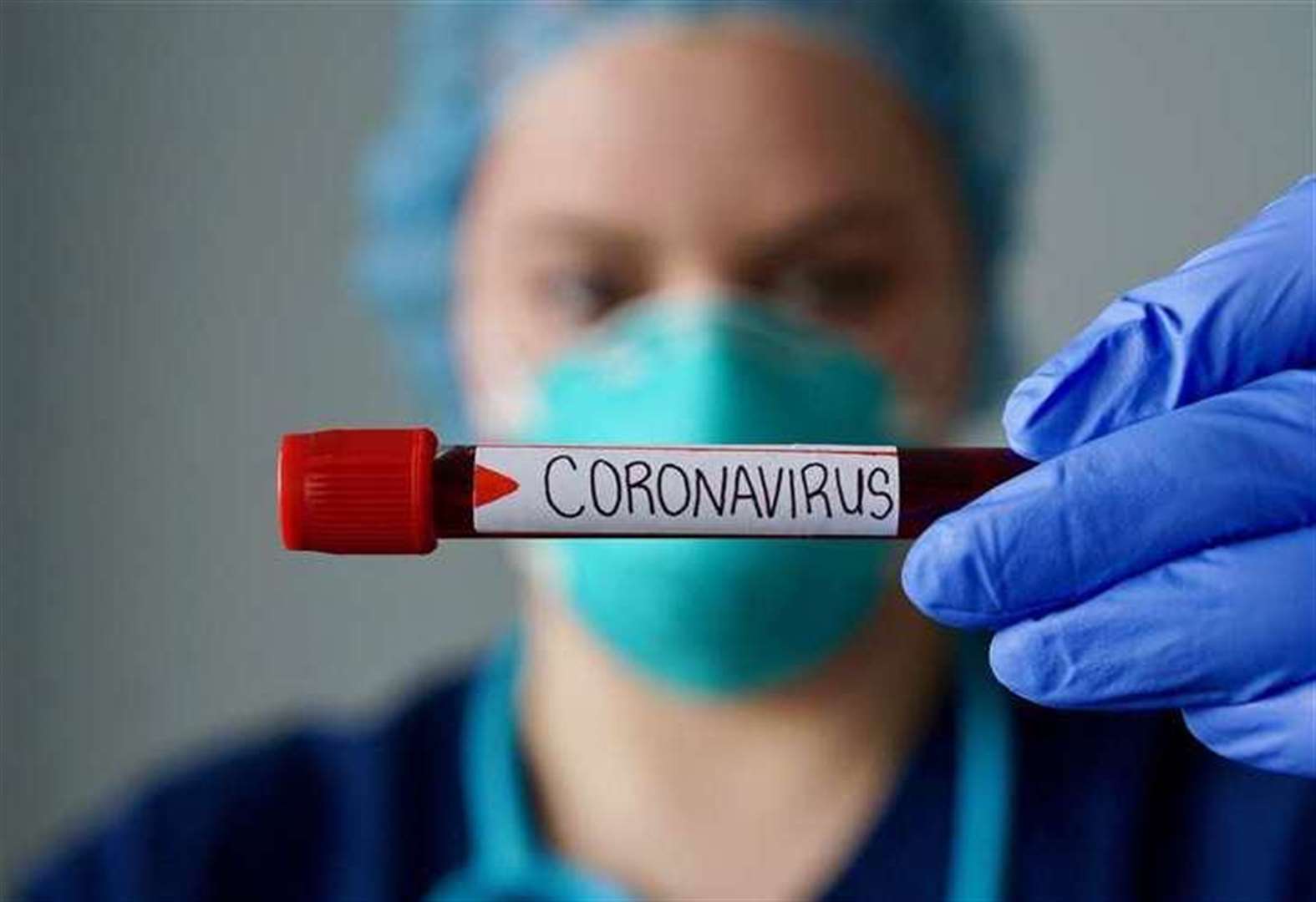 IJZ: Još pet žrtava koronavirusa, 499 novozaraženih
