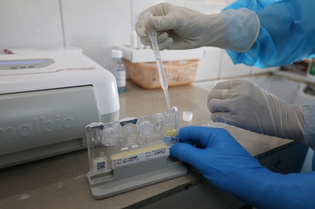 U Hrvatskoj 8.958 novih slučajeva zaraze koronavirusom, preminulo 35 osoba