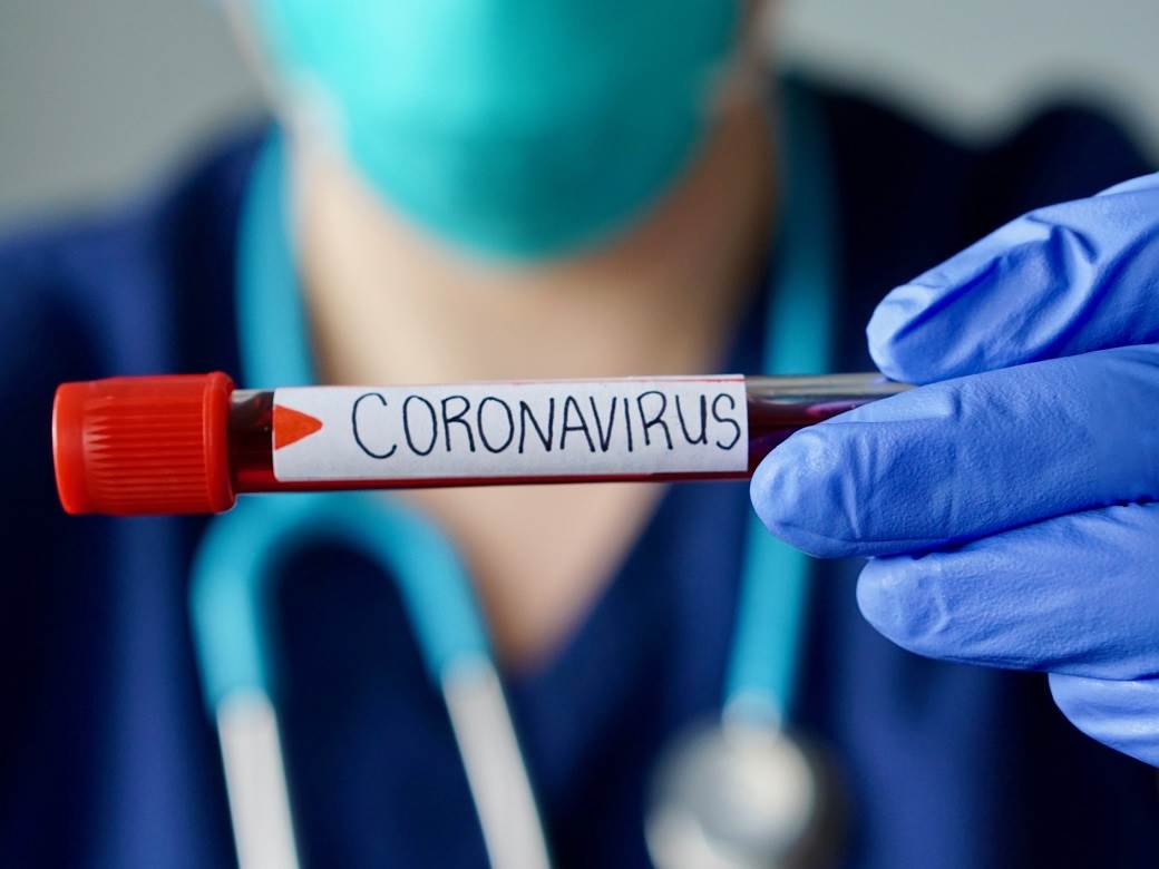 Korona presjek: Preminule dvije osobe, 501 novozaraženi