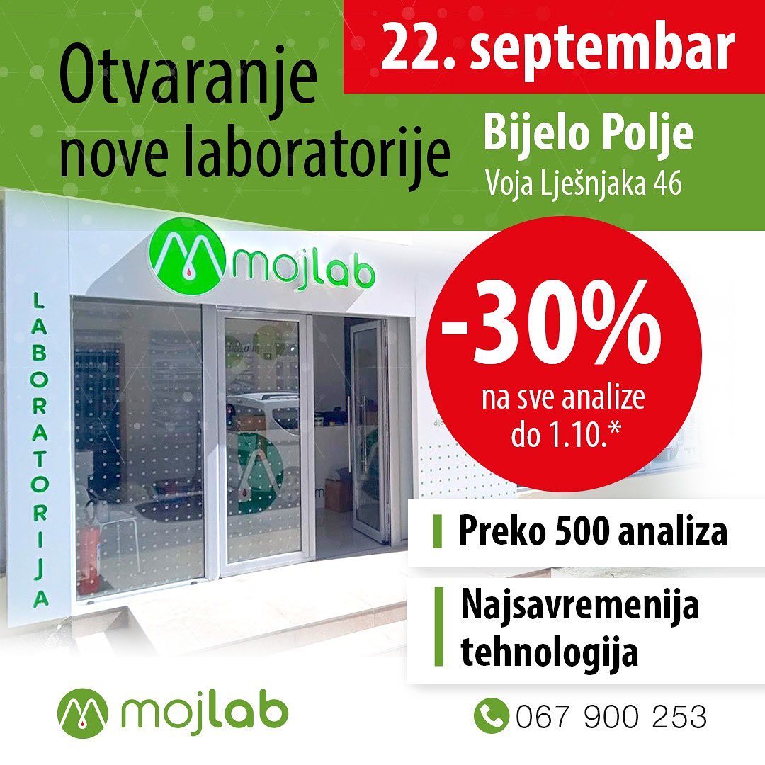 Moj Lab – nova laboratorija i specijalna akcija: Najsavremenija laboratorija od sada i u Bijelom Polju!