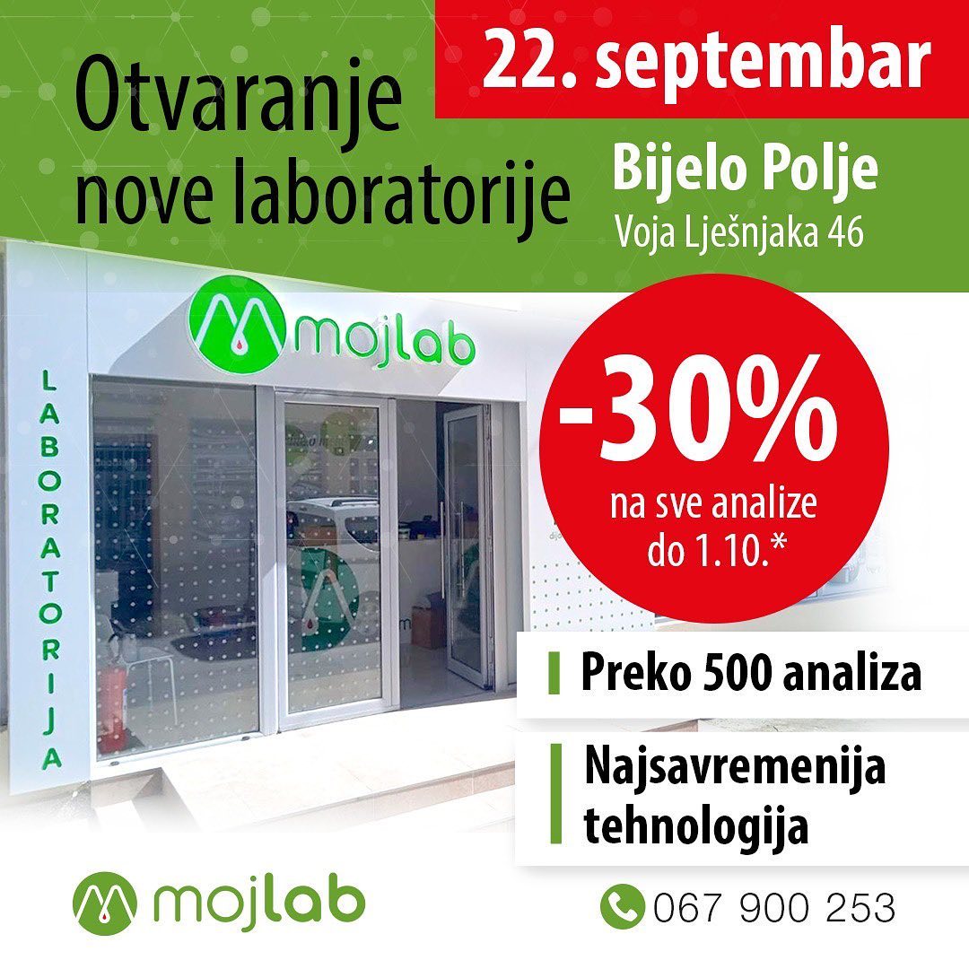 Moj Lab &#8211; nova laboratorija i specijalna akcija: Najsavremenija laboratorija od sada i u Bijelom Polju!