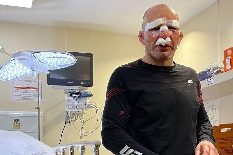 Legendarni brazilski borac pokazao kako izgleda lice nakon što primiš 200 udaraca u glavu