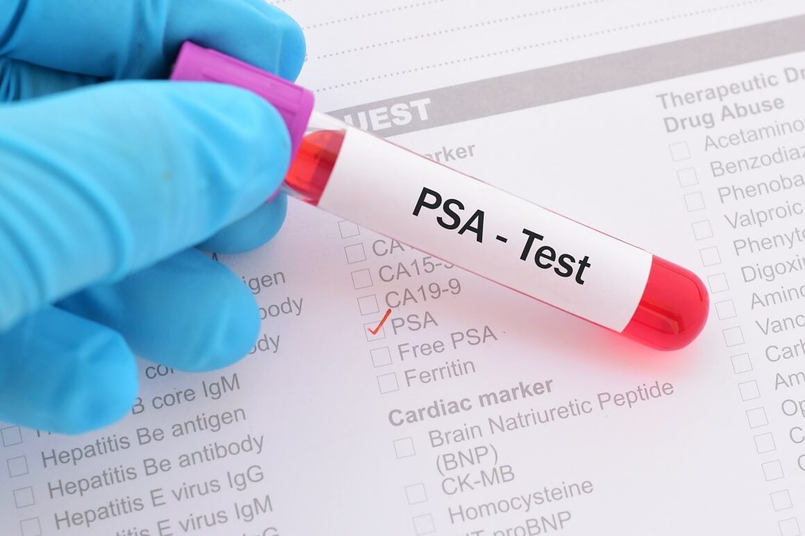 RAK PROSTATE VIŠE NIJE BAUK: Godišnji pregled obavezan za muškarca starije od 50 godina, prevenicija i rano otkrivanje ključ, u CG godišnje 136 novooboljelih