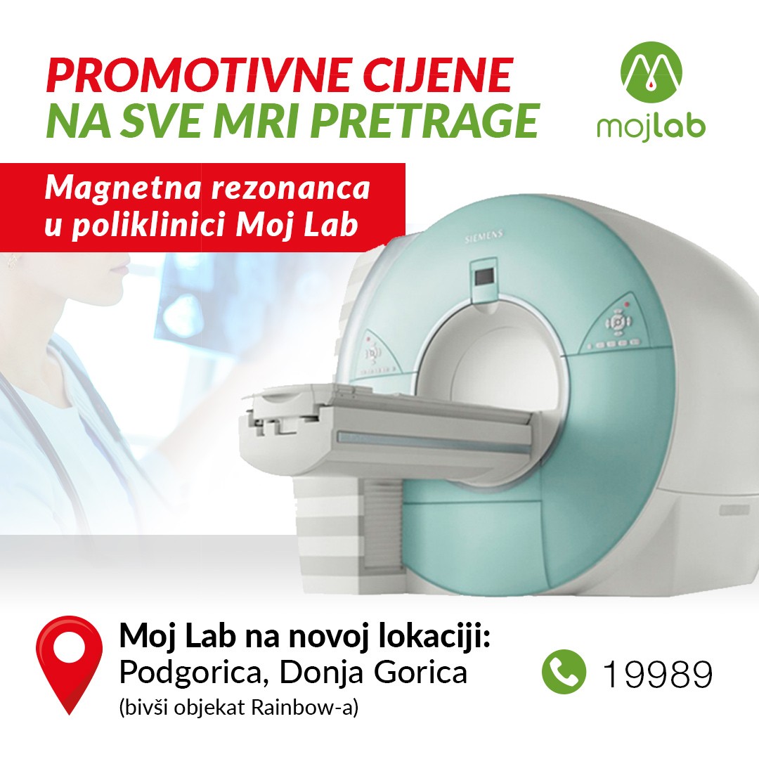 Najnovija Siemens magnetna rezonanca u Poliklinici „Moj Lab“: Promotivne cijene do kraja marta