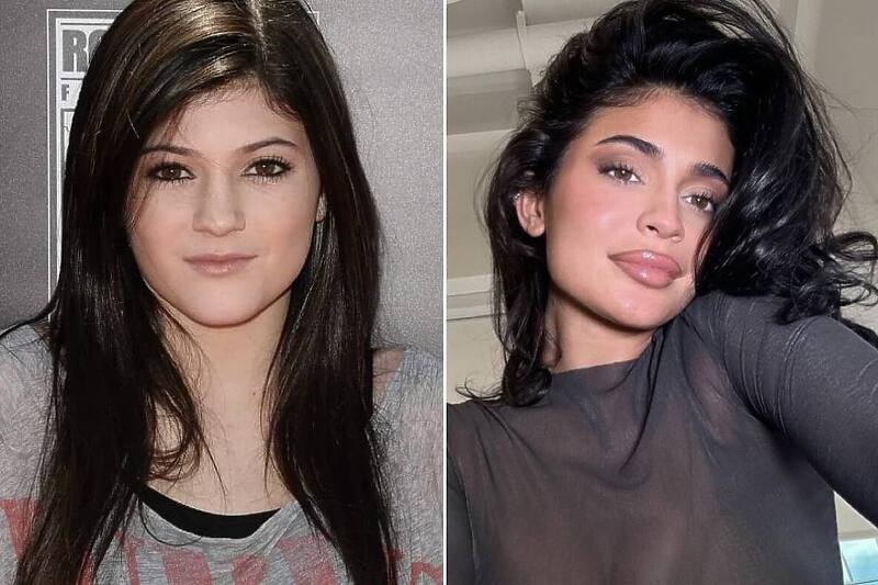 Koliko se Kylie Jenner promijenila od početka karijere: Izjavila da nije išla &#8220;pod nož&#8221;