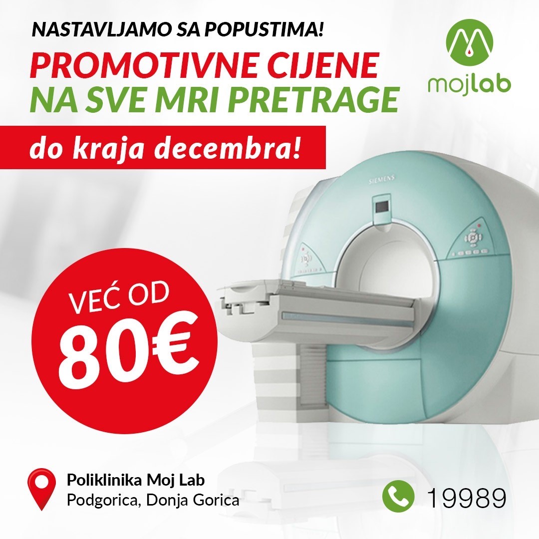 Akcija promotivnih cijena za preglede na magnetnoj rezonanci se nastavlja do kraja decembra!