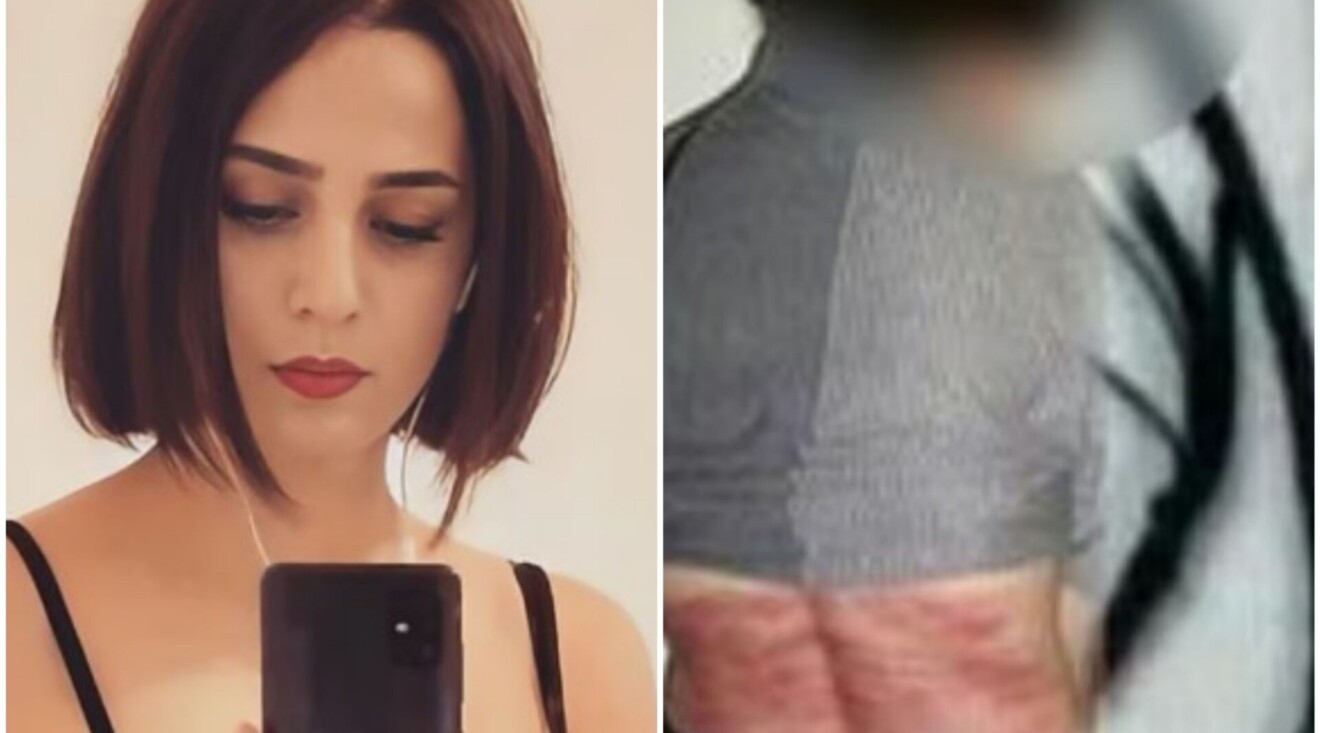 Djevojka dobila 74 udarca bičem jer nije nosila hidžab