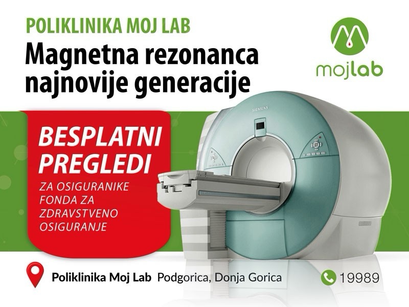 U Poliklinici Moj Lab besplatni pregledi magnetnim rezonancama