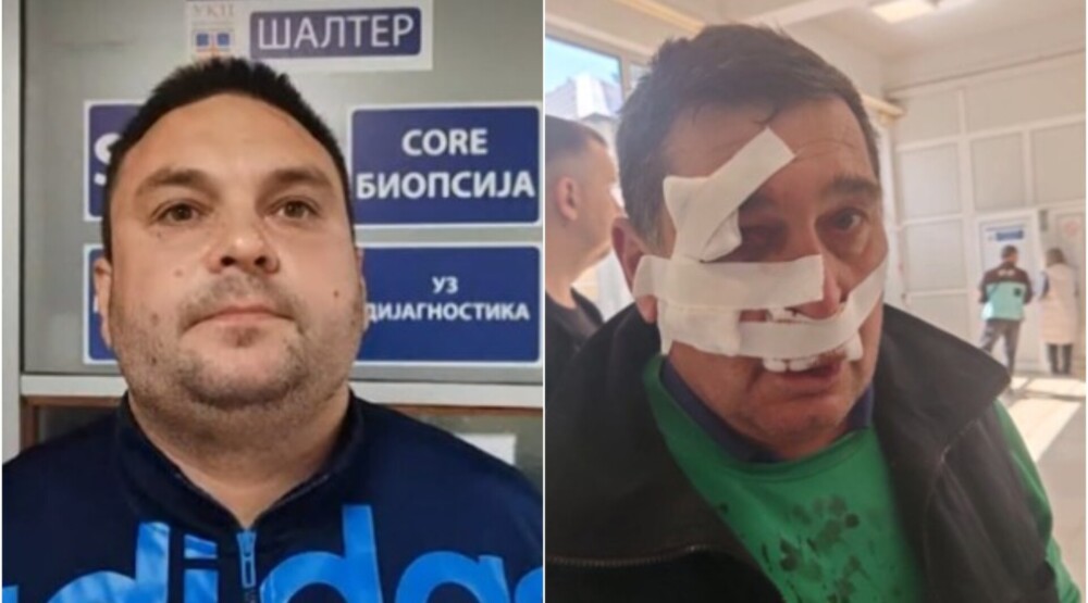 Otac i sin pretučeni kod Topole zbog poruke „pumpaj, pumpaj“ mitingašima SNS