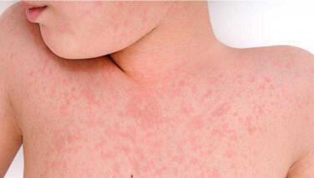 Ilustracija, Foto: Dan