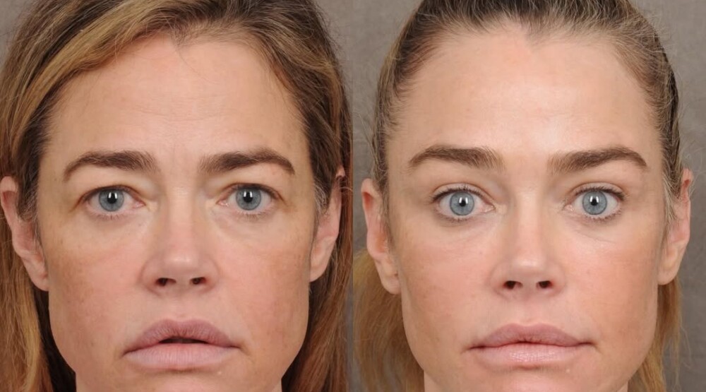 Deniz Ričards, Foto: Printscreen/ CdM